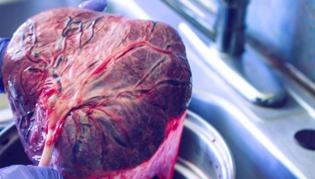 Comer placenta é uma prática natural ou é maluquice?