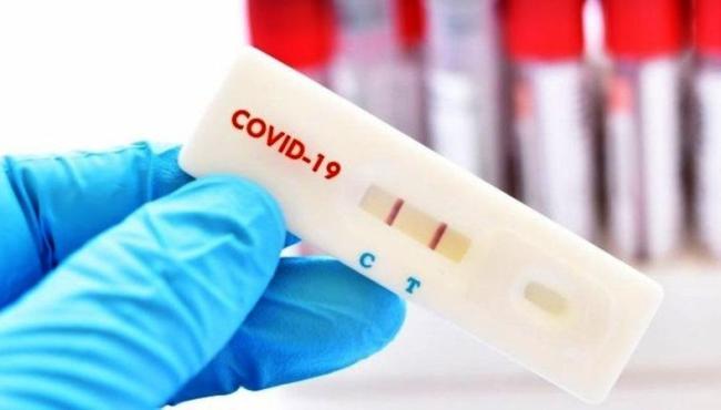 Conceição da Barra chega a 75 mortes e 6.448 casos de Covid-19