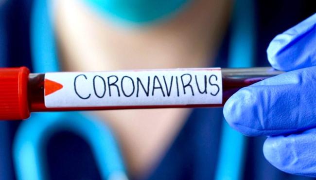 Conceição da Barra registra 1 infectado e casos de Covid-19 sobe para 5.629