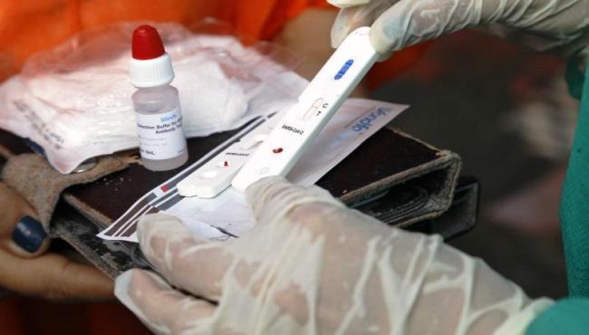 Conceição da Barra registra 1 infectado e vai a 6.539 casos de Covid-19
