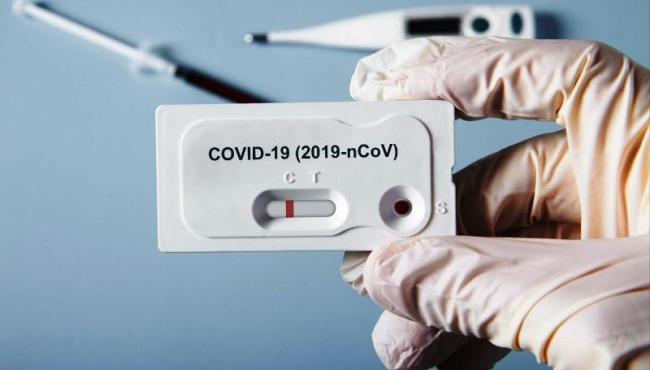 Conceição da Barra registra 2 novos casos de Covid-19; total de infectados vai a 1.984