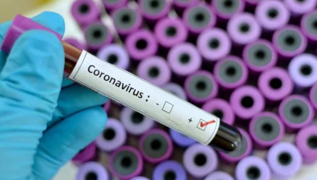 Conceição da Barra registra mais 1 infectado por Covid-19 e vai a 2.127