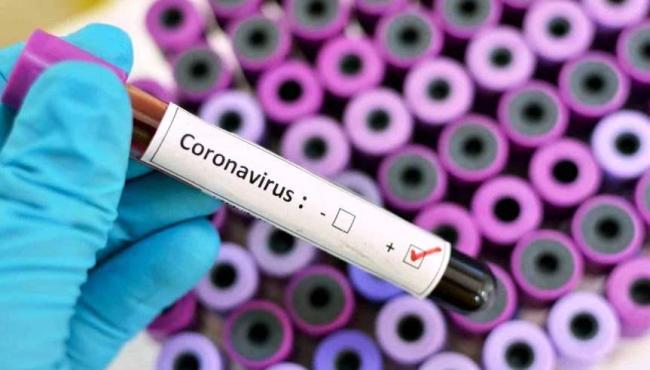 Conceição da Barra tem 1 novo infectado e vai a 2.045 casos de Covid-19