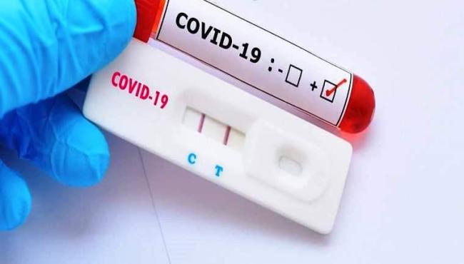 Conceição da Barra tem 1 novo infectado por Covid-19 e vai a 5.679 casos confirmados