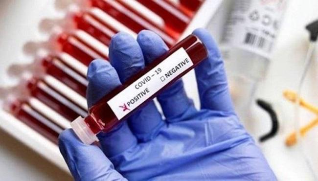 Conceição da Barra tem 25 novos infectados e chega a 7.109 casos de Covid-19