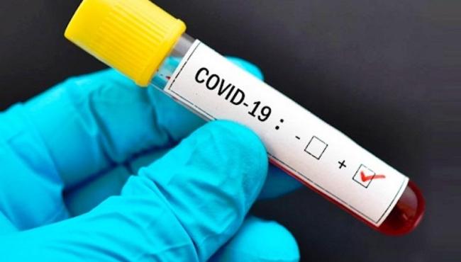 Conceição da Barra tem 66 vidas perdidas pela pandemia e 2.013 casos de Covid-19