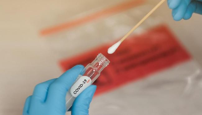 Conceição da Barra tem mais 1 infectado e número de casos de Covid-19 vai a 5.628