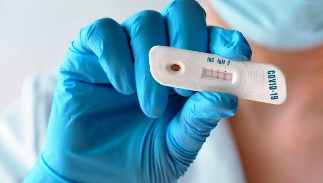 Conceição da Barra tem 1 novo infectado pela Covid-19 e vai a 2.021 casos da doença