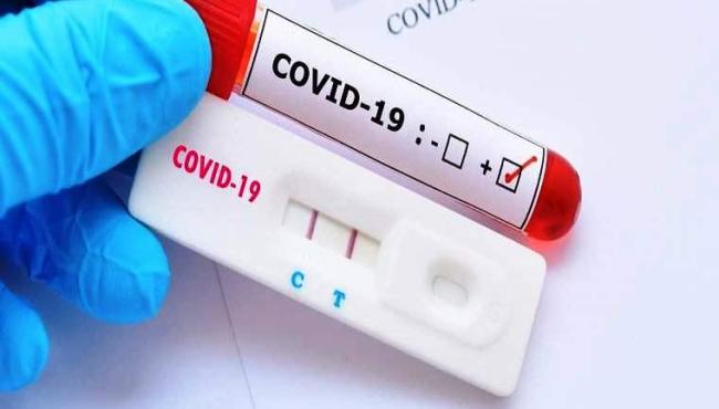 Conceição da Barra tem mais 1 infectado por Covid-19 e vai a 5.659 casos confirmados