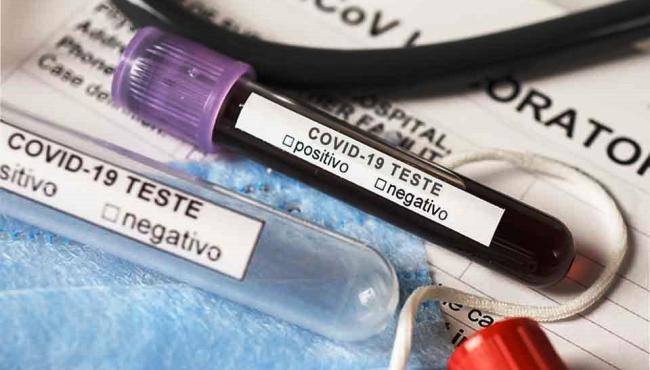 Conceição da Barra tem mais 2 infectados por Covid-19 e vai a 2.275 casos