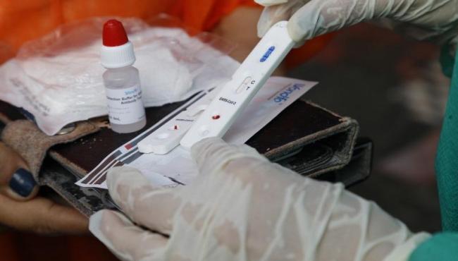 Conceição da Barra tem mais 4 casos e chega a 5.791 infectados por Covid-19