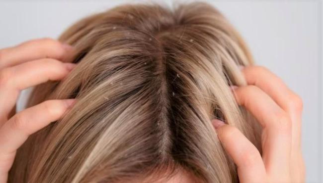 Couro cabeludo também envelhece: saiba como prevenir o processo