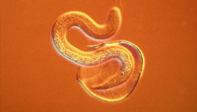 Devemos tomar vermífugo todo ano, mesmo depois de adulto? Tire dúvidas