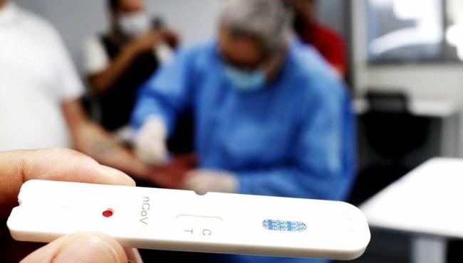Em 24 horas, Brasil tem 13.510 casos e 69 óbitos por covid-19