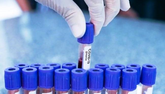 Em 24 horas país registra 182 mortes e quase 15 mil novos de Covid-19 casos