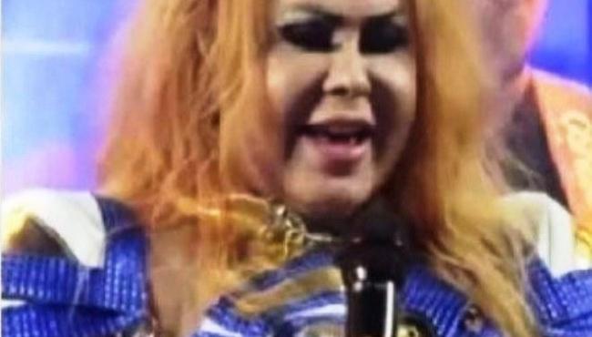 Joelma: Entenda o que pode ter causado o inchaço no rosto da cantora