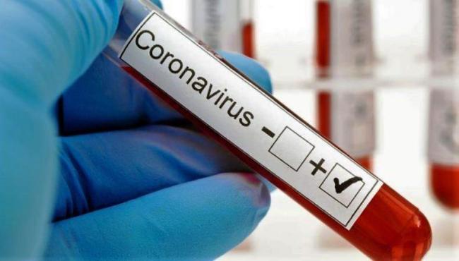 ES registra 1.502 casos e 71 mortes por Covid-19 em 24 hora; total de óbitos chega a 10.798