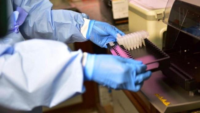 ES registra 119 novos infectados por Covid-19 e chega a 1.045.510 casos confirmados
