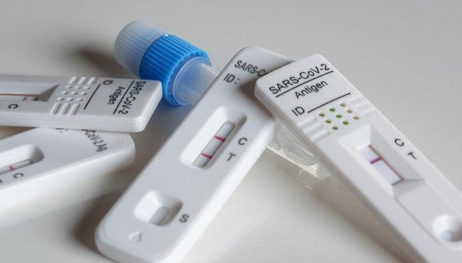 ES registra 121 novos casos de Covid-19 em 24 horas e nenhuma morte