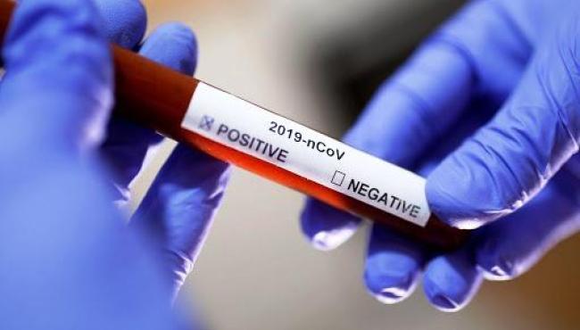 ES registra 282 novos casos de Covid-19 e 22 mortes nesta terça-feira (29)