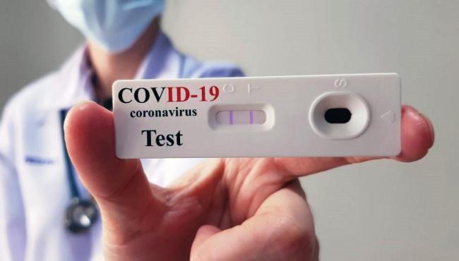 ES registra 3 mortes e 311 novos casos de Covid-19 nesta sexta-feira (17)