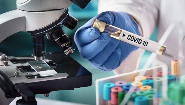 ES registra 3 mortes e 458 novos casos de Covid-19 neste sábado (23)