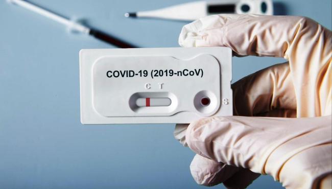 ES registra 903 casos de Covid-19 e apenas 2 mortes pela doença, neste sábado (25)