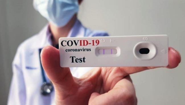 ES registra 986 novos infectados por Covid-19 e chega 579.781 casos confirmados