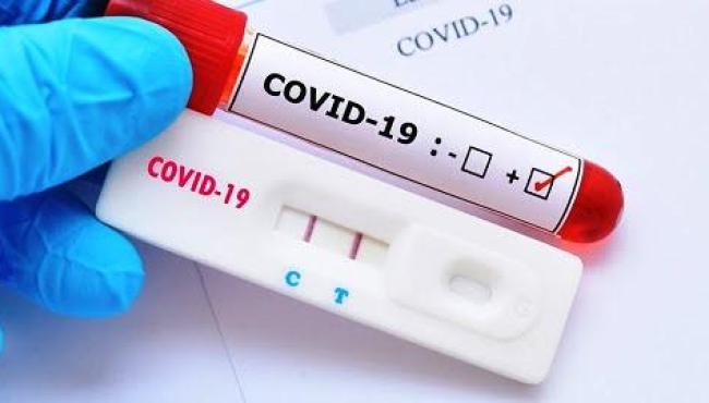 ES registra apenas 3 mortes e 401 casos de Covid-19 neste domingo (18)