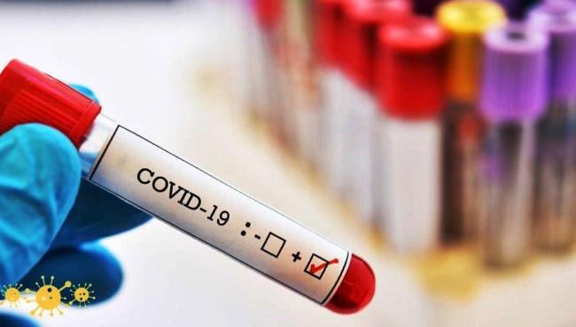ES registra mais 47 mortes pela Covid-19 e 1.229 infectados em apenas 24 horas