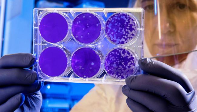 ES tem 566.429 casos de Covid-19; número de mortes pela pandemia chega a 12.302