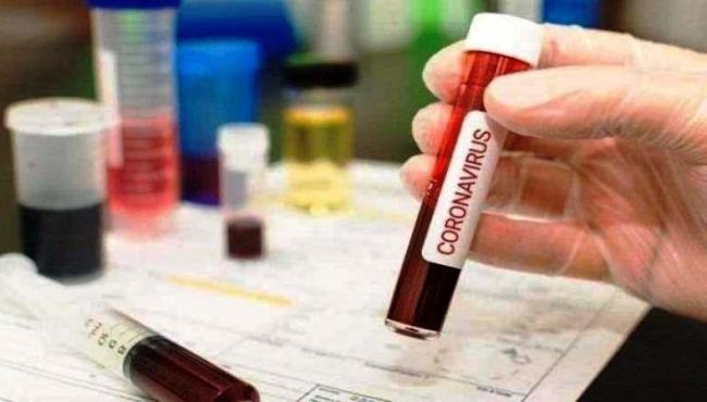 Espírito Santo tem 3.572 mortes por covid-19 e 133.744 casos da doença