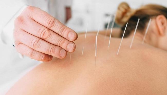 Governo do Brasil regulamenta o exercício profissional de acupuntura
