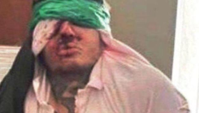 Grupo neonazista tortura e mata lutador de MMA na Ucrânia