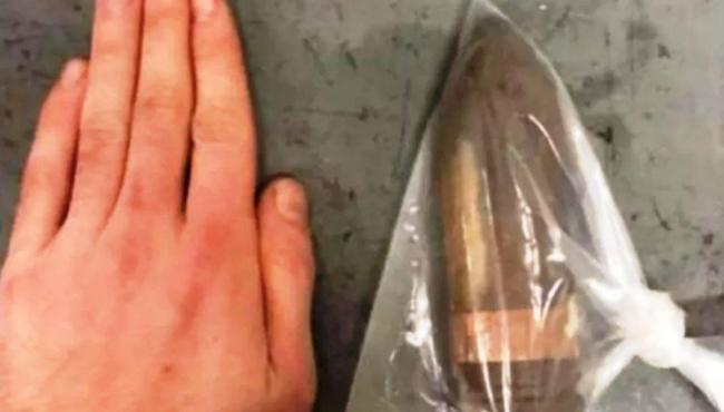 Homem dá entrada em hospital com bala de canhão de 17 cm no ânus