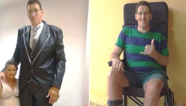 Homem mais alto do Brasil marca cirurgia para amputar perna: ‘Melhorar a minha saúde’