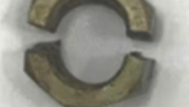 Homem prende porca de 2 cm no pênis durante masturbação