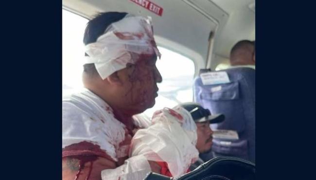 Homem sequestra avião em Belize e é morto a tiros por passageiro após o pouso, diz polícia