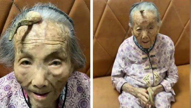 Idosa de 104 anos viraliza na internet com seu curioso ‘chifre’