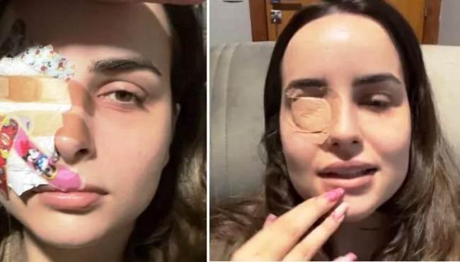 Influenciadora rasga parte da córnea ao coçar os olhos com as unhas grandes