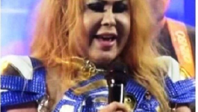 Internada, Joelma é diagnosticada com esofagite, gastrite e edema; cantora cancela três shows