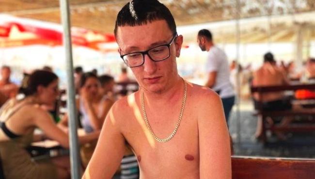 Jovem com condição rara tem ossos crescendo ‘fora do esqueleto’