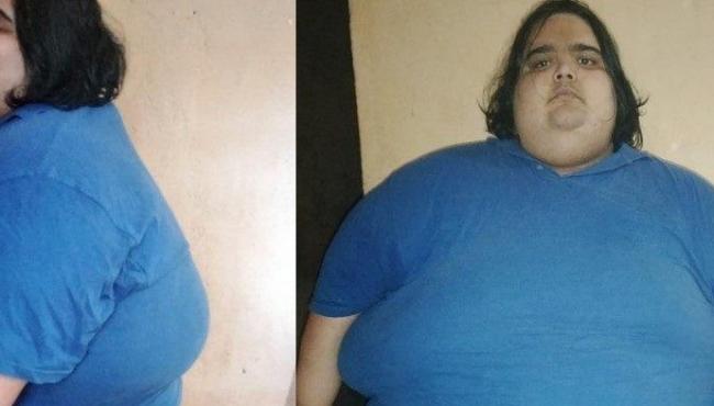 Jovem passa dos 300 kg e não consegue mais se pesar: ‘tenho muita fome’