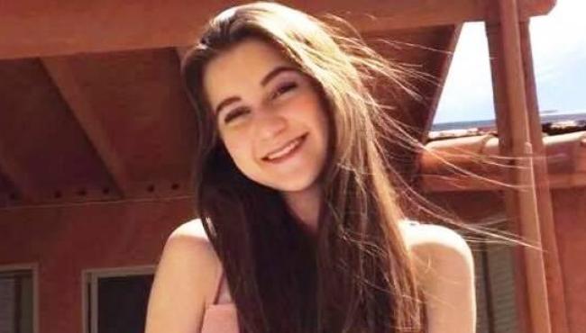 Jovem sofre de alergia à água, caso raro que acontece com uma a cada 200 milhões de pessoas