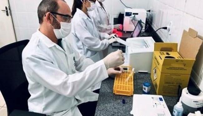 Laboratório Regional Norte recebe equipamento para exames rápidos de HIV e hepatite C