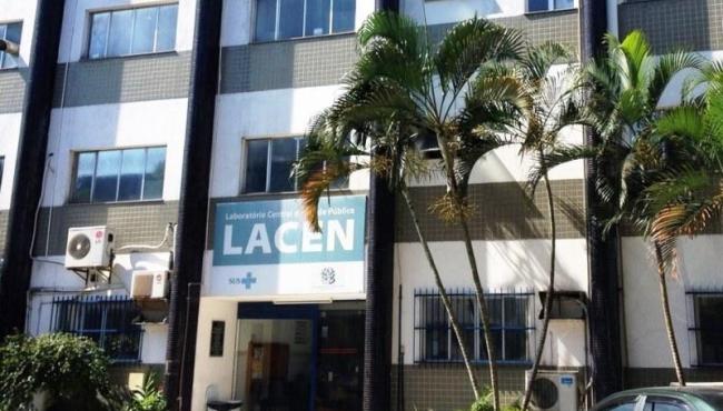 Lacen/ES realiza em três meses o equivalente a 20 anos de rotina de testagem