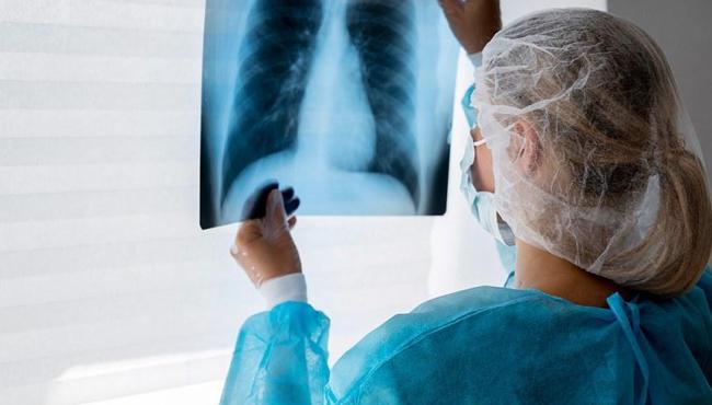 Lei institui campanha para conscientização sobre câncer de pulmão