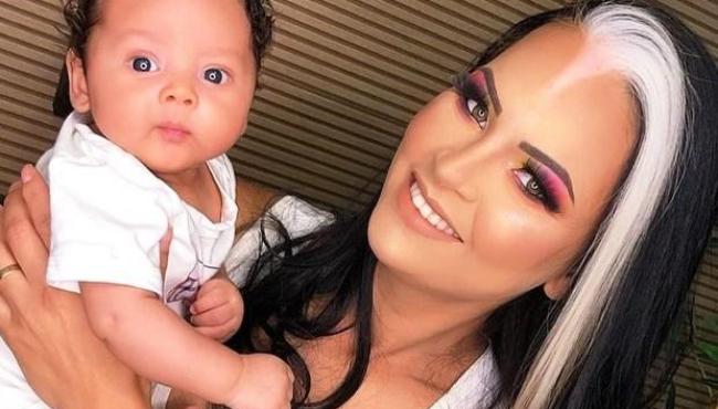 Mãe e bebê com condição rara fazem sucesso nas redes sociais: “Perguntam se pintamos os cabelos”
