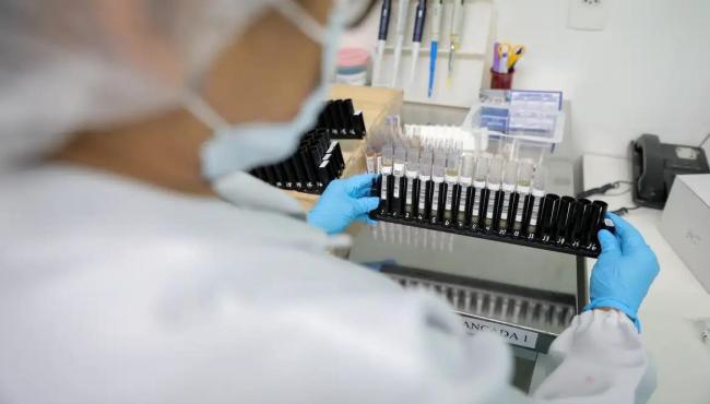 Malária: Anvisa autoriza teste em humanos de vacina 100% brasileira