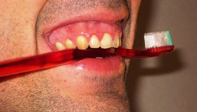 Manter a higiene da boca em dia pode ajudar na prevenção do câncer de intestino